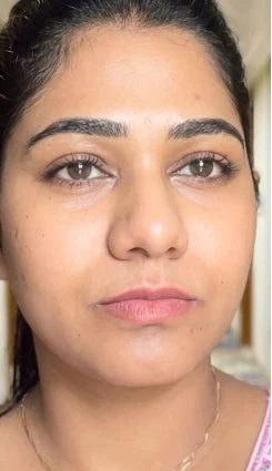 Sunita P. after