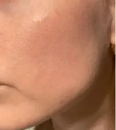 Olivia G. after